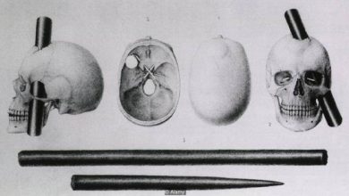 gage beyin hasari bilimfili