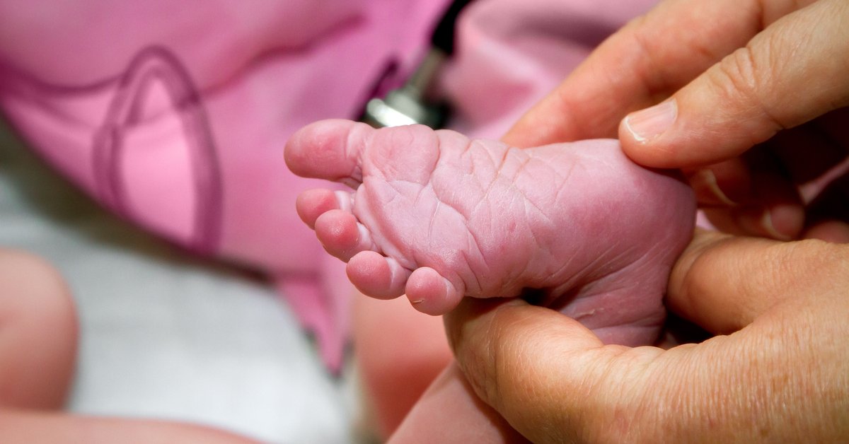 Babinski Refleksi Nedir? Babinski Refleksi Testi Nasıl Yapılır?