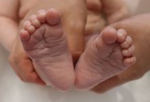 Babinski Refleksi Nedir? Babinski Refleksi Testi Nasıl Yapılır?