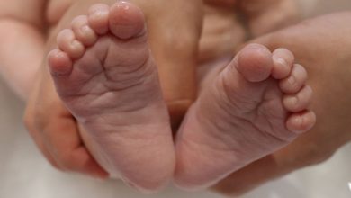 Babinski Refleksi Nedir? Babinski Refleksi Testi Nasıl Yapılır?